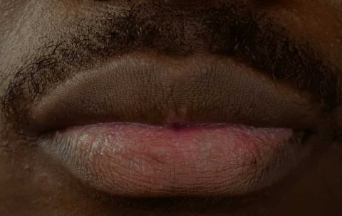 Advanced-Dermal-Fillers-Elevating-the-Oral-Commissures-Refresher-Course--best-you-training-2024