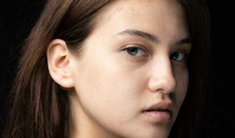 Advanced-Dermal-Fillers-Non-Surgical-Rhinoplasty-Refresher-Course--Best-You-Training