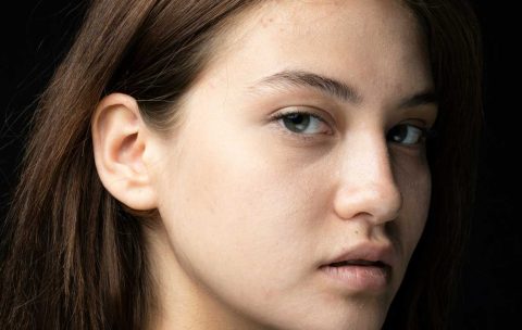 Advanced-Dermal-Fillers-Non-Surgical-Rhinoplasty-Refresher-Course--Best-You-Training