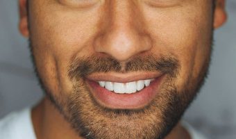 Dermal-Fillers-Marionette-lines-Nasolabial-Folds-Refresher--best-you-training-2024