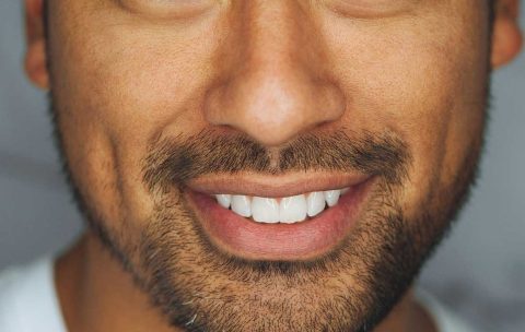 Dermal-Fillers-Marionette-lines-Nasolabial-Folds-Refresher--best-you-training-2024