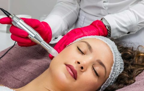 VTCT-ITEC-Level-4-in-Microneedling--Best-You-Training-2024