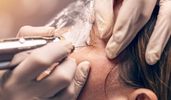 VTCT-Level-4-Enhance-Appearance-Using-Plasma-Pen-Technique--Best-You-Training-2024