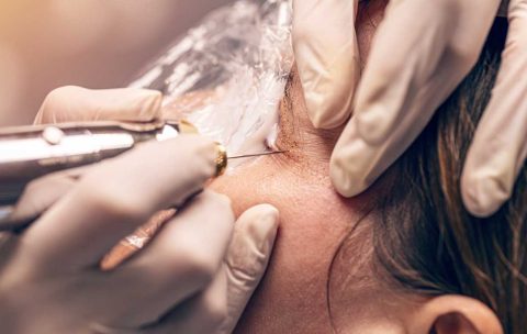 VTCT-Level-4-Enhance-Appearance-Using-Plasma-Pen-Technique--Best-You-Training-2024