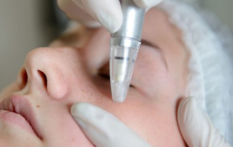 best-you-training-microdermabrasion